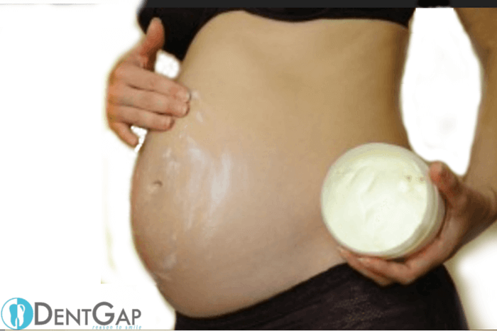 is coconut oil good for stretch marks