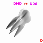 DMD vs DDS