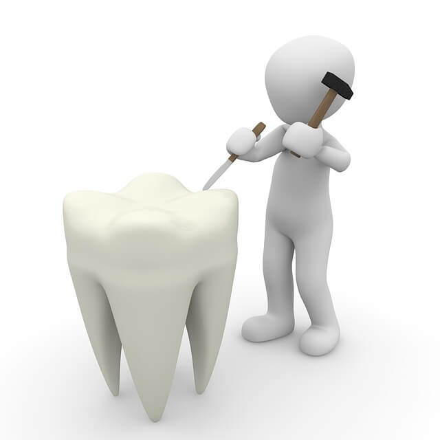 Affordable dental implants