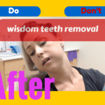 what to do after wisdom teeth removal