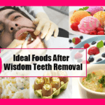 Best Foods to Eat After Tooth Extraction & Wisdom Tooth Removal