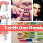 Teeth Gap Bands Do they Work Types & Side Effects of Bands