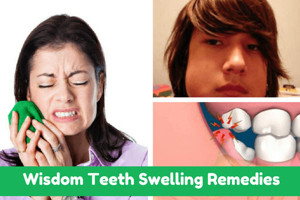 Wisdom Teeth Swelling Remedies (Important Guide)