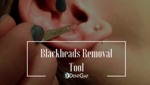 Blackheads Removal with blackhead extraction tool